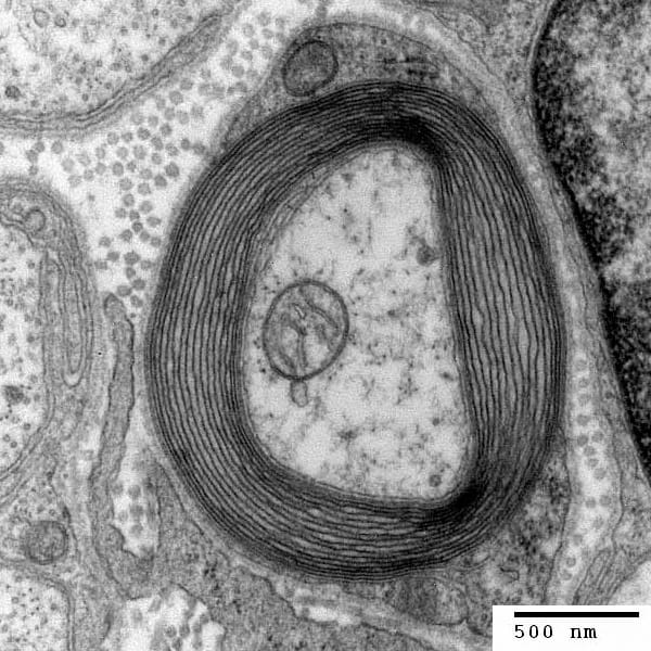 A myelinated axon. Insulation forces the pulse to regenerate only at the gaps between sheath segments, which increases conduction velocity by a factor of up to fifty.