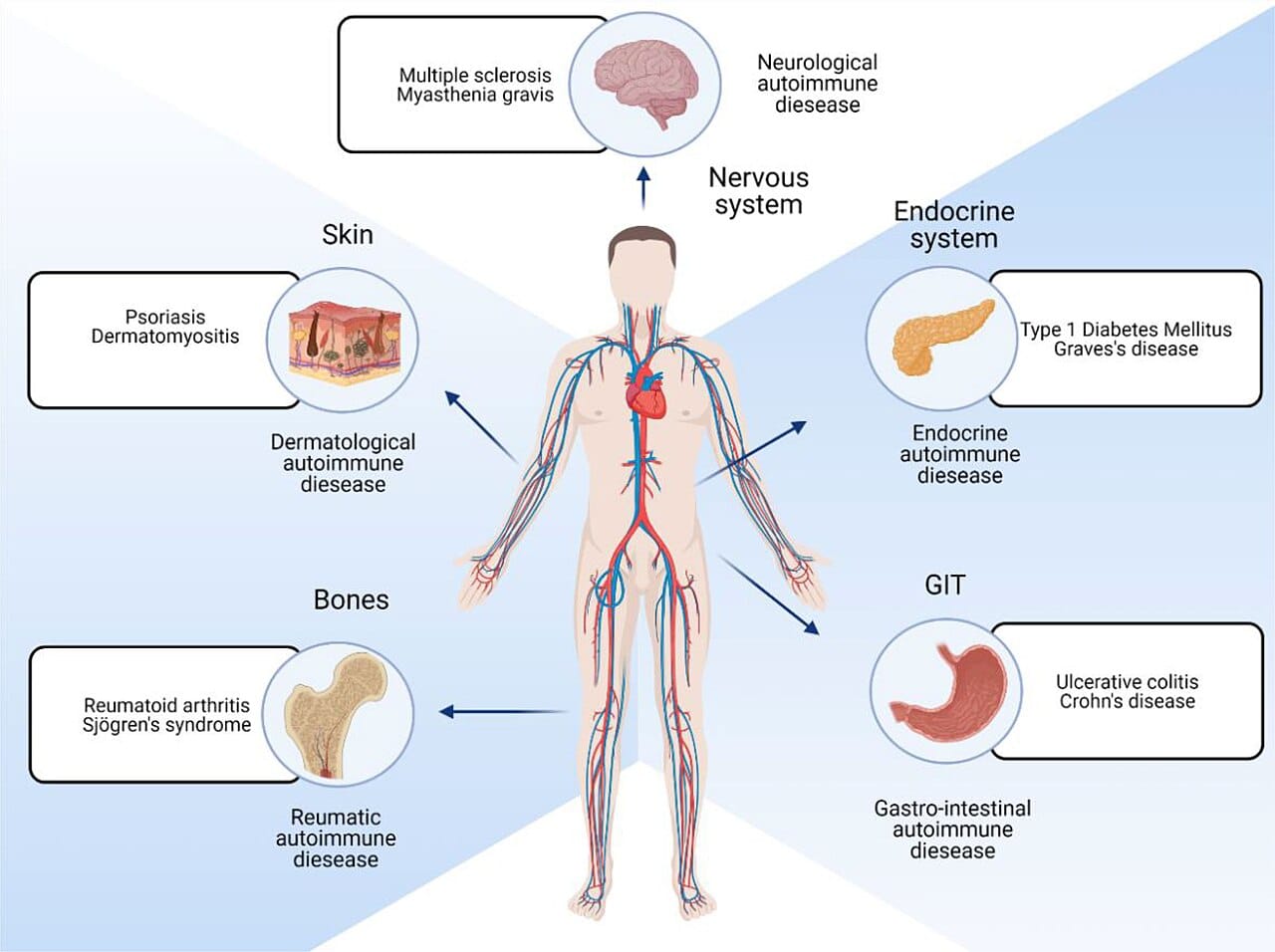 Immune mechanisms in autoimmune disease. Self-reactive cells are normally removed during development or suppressed afterwards, and autoimmunity is what follows when both layers fail.