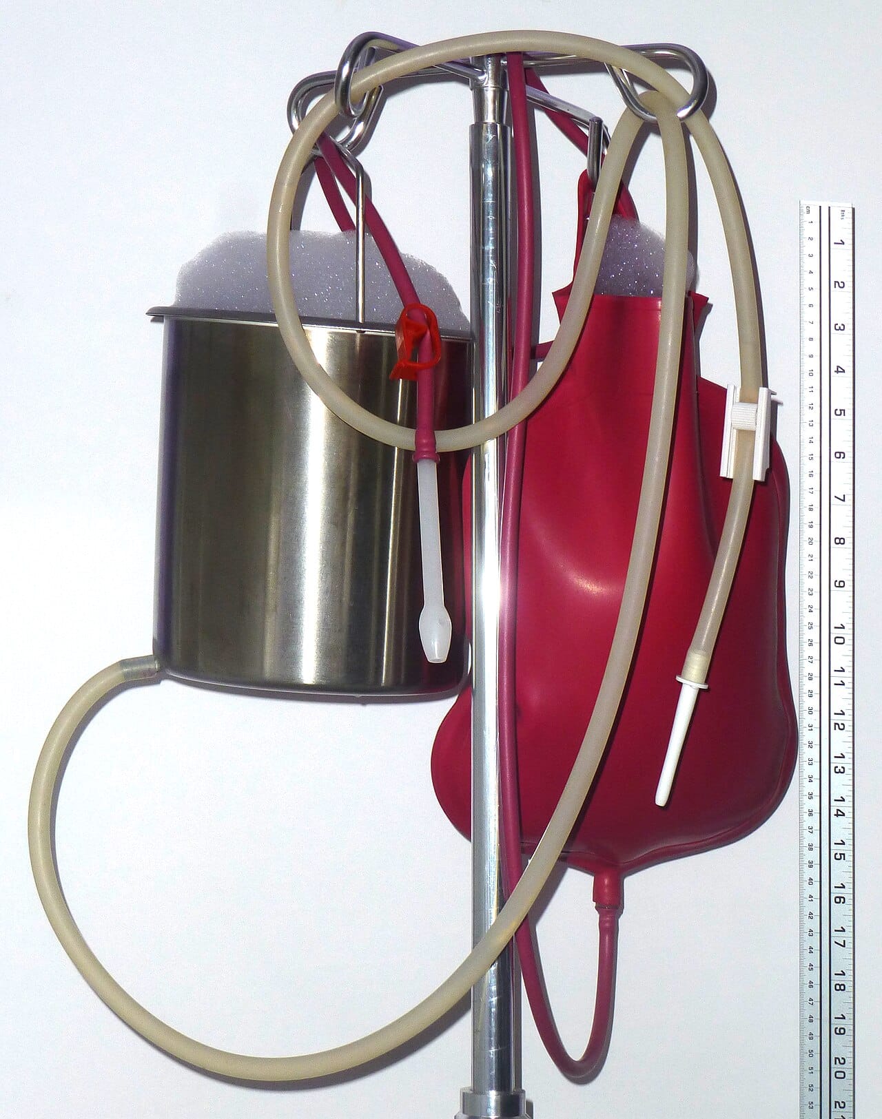 Equipment for cleansing enemas. The practice long outlived the theory that justified it, and it is the direct ancestor of modern colonic irrigation.