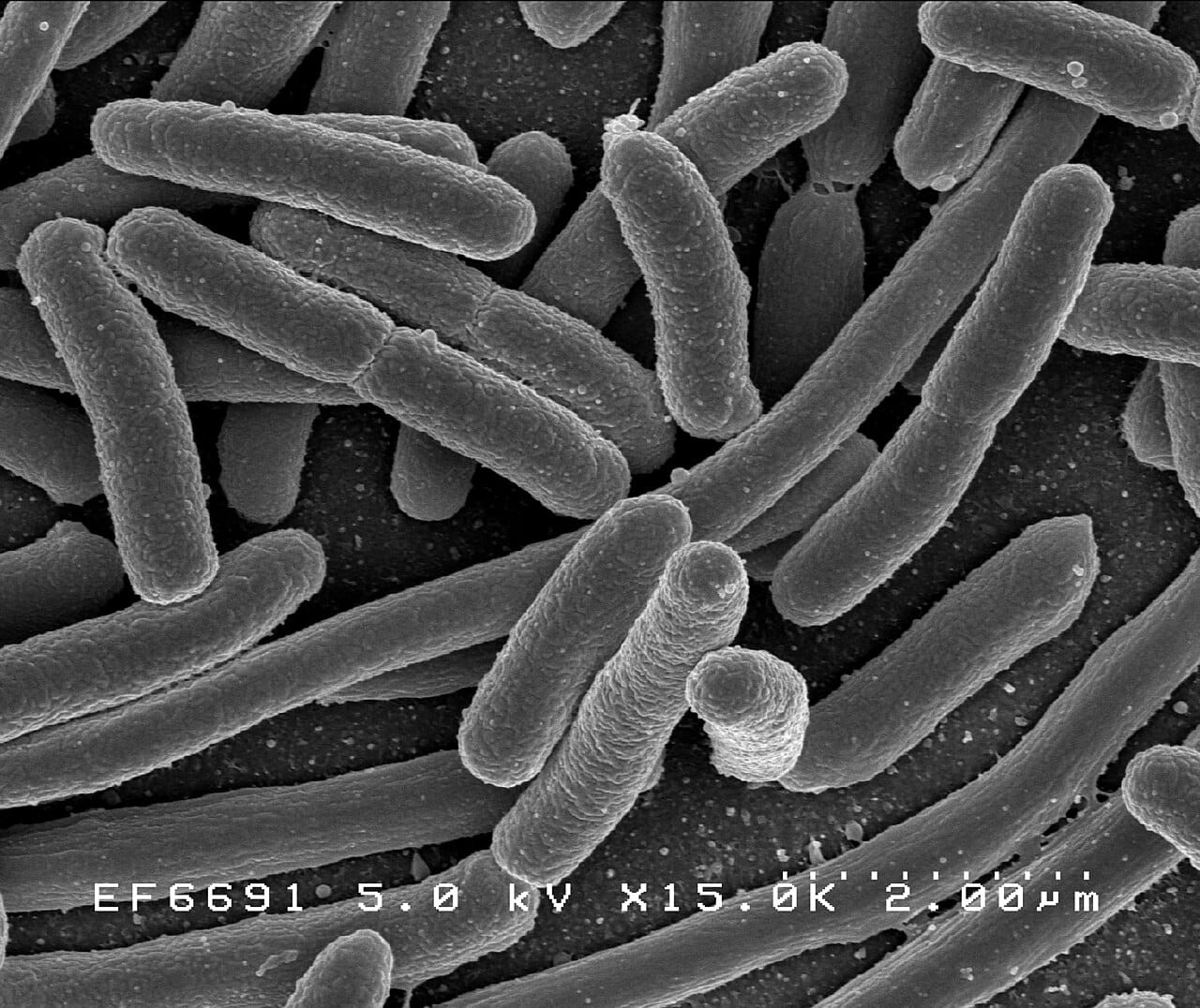 Escherichia coli. Bacteria are typically a few micrometres long, which is roughly a hundredth the length of a typical human cell.