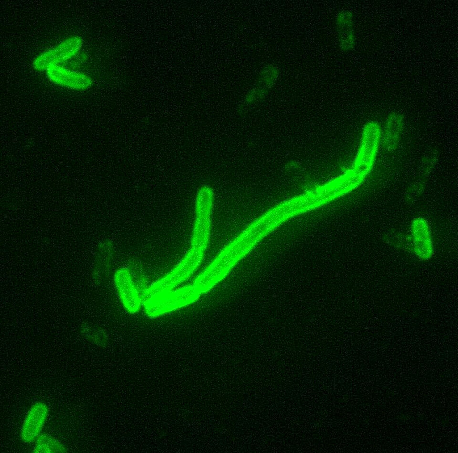 The bacterium Yersinia pestis, the cause of the plague, seen under magnification.