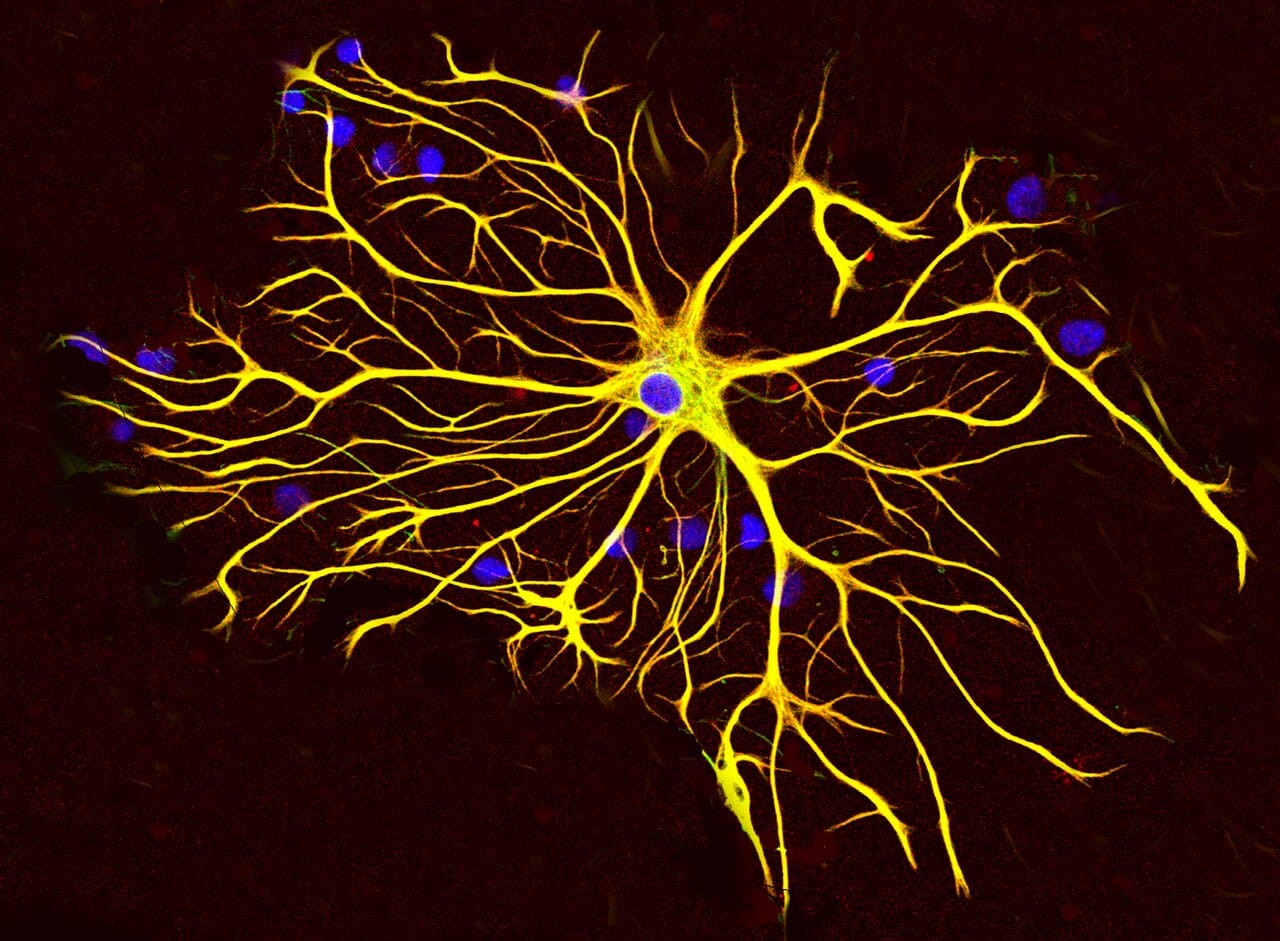 An astrocyte. Its end-feet cover the capillary surface and induce the barrier properties in the endothelial cells rather than forming the barrier themselves.