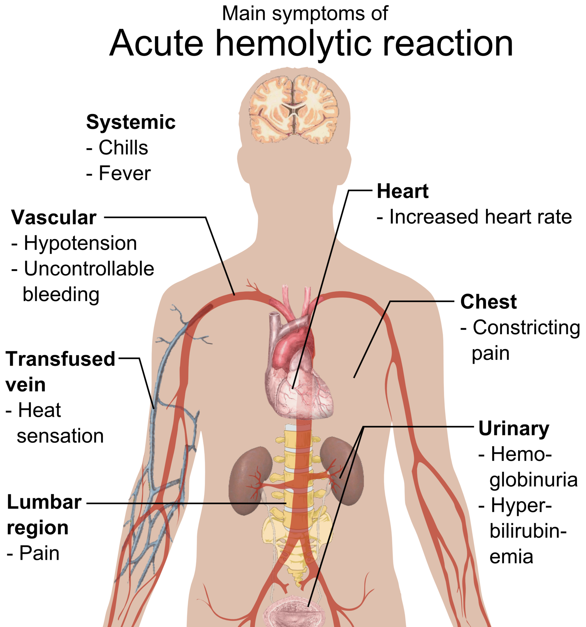 A blood sample being taken; matching blood types is essential for safe transfusion.