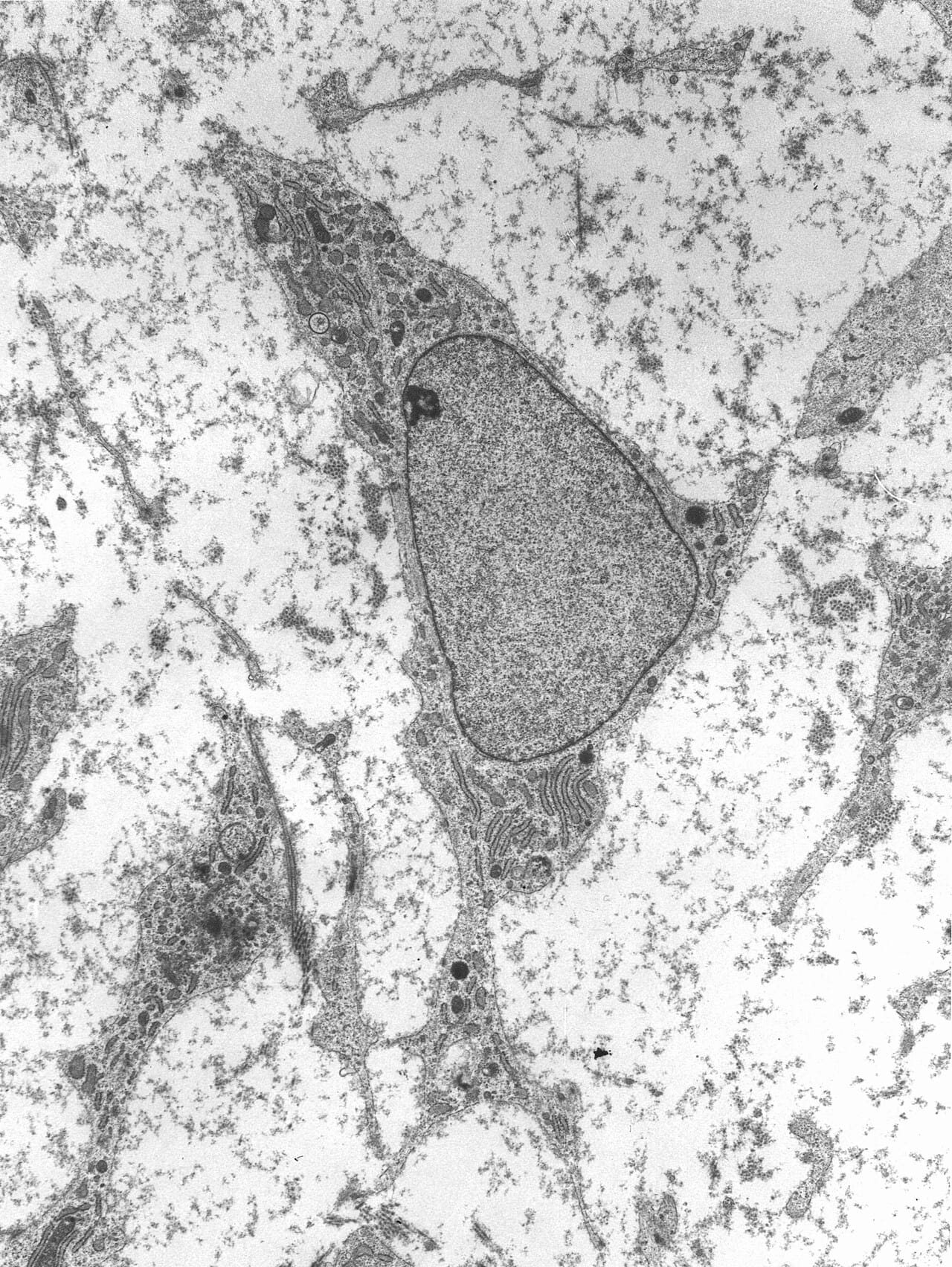 Cultured stem cells. Whether the cancer equivalent is a fixed cell type or a reversible state that any tumour cell can enter is the question the hypothesis turns on.