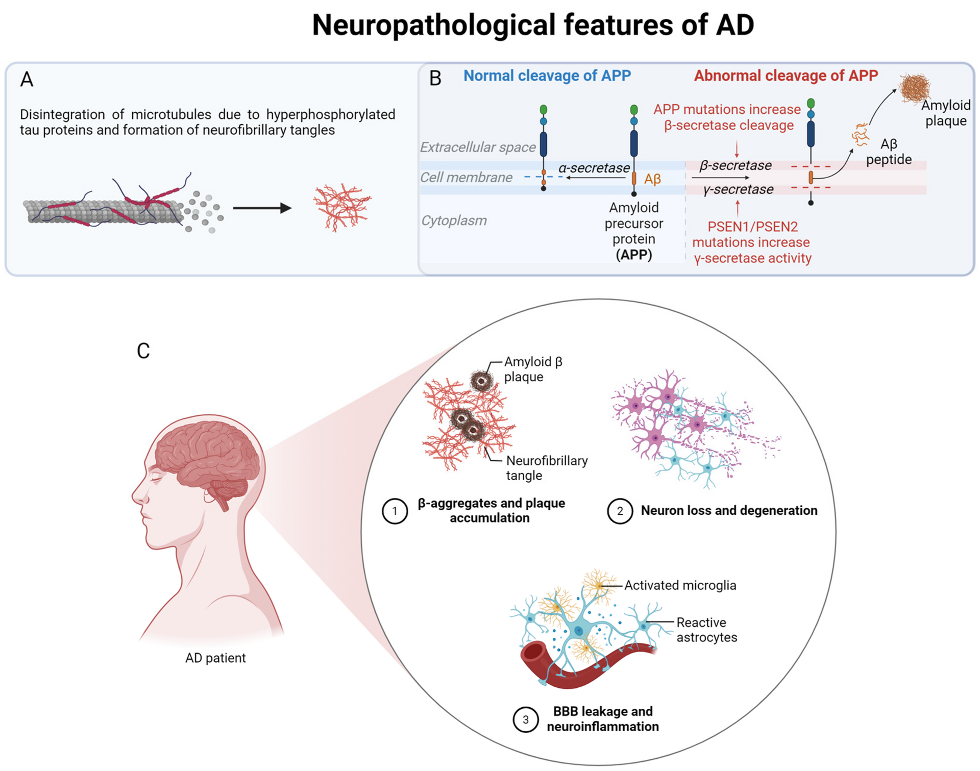 A diagram of the protein changes seen in the brain in Alzheimer's disease.