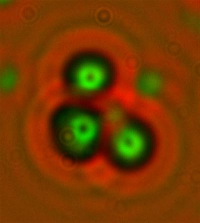 "Triple tracks" in a CR-39 plastic radiation detector claimed as evidence for neutron emission from palladium deuteride Credit: US gov (Public domain).