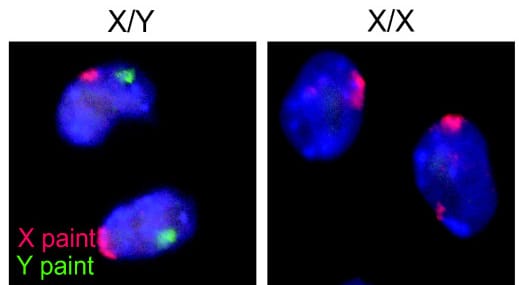 Germ cells. The lineage they belong to must persist indefinitely, and receives protection that the body carrying it does not.