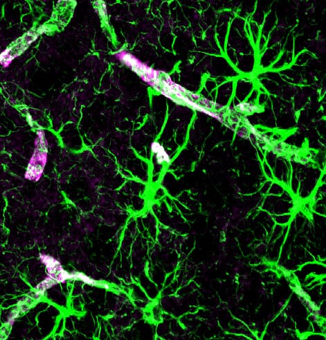 Astrocytes. Their end-feet form the channels the hypothesis proposes, and the aquaporin-4 water channels concentrated there are the mechanism for moving fluid through brain tissue.