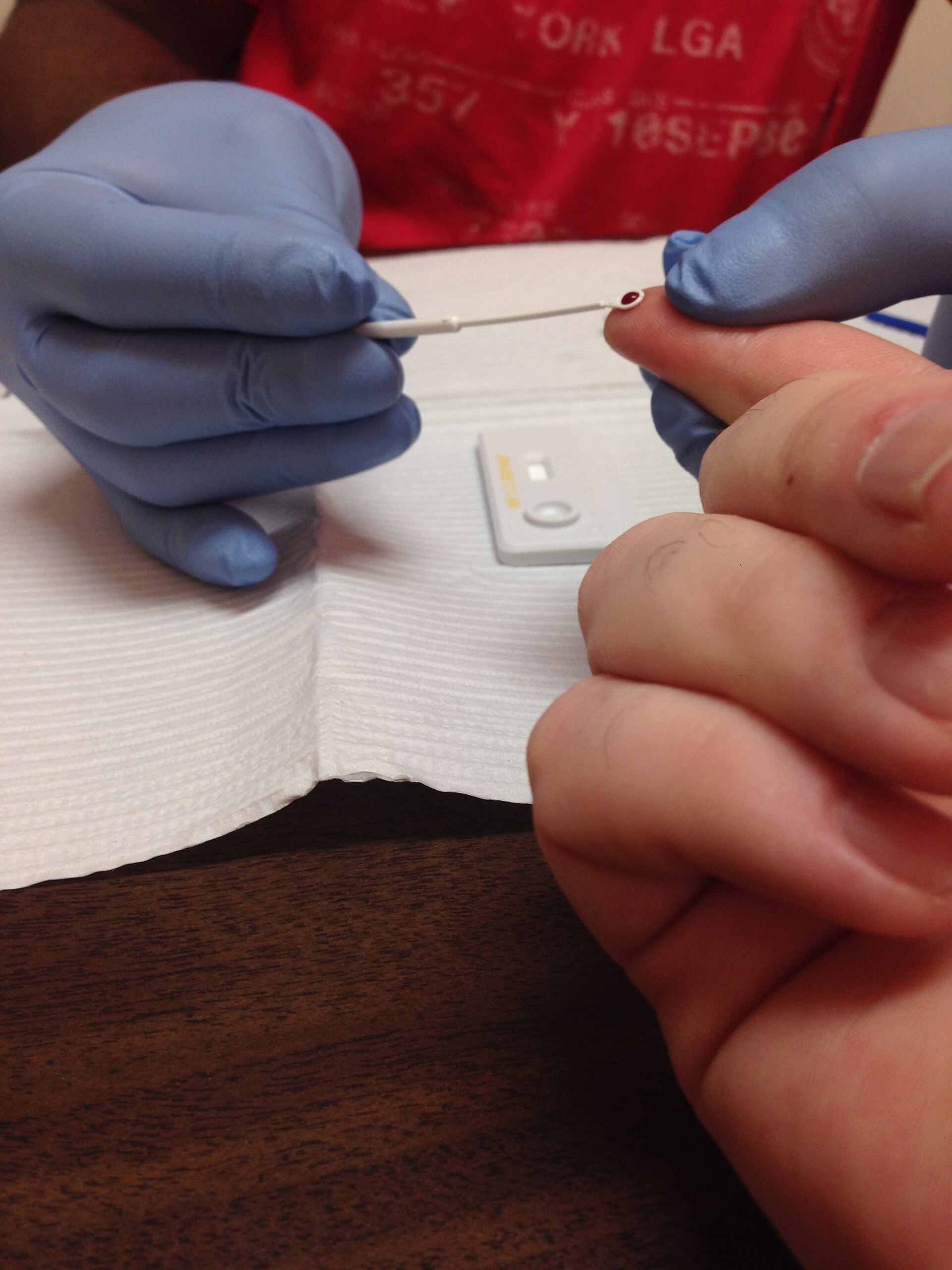 An HIV rapid test, one of the tools that made diagnosis and study of the virus widespread.
