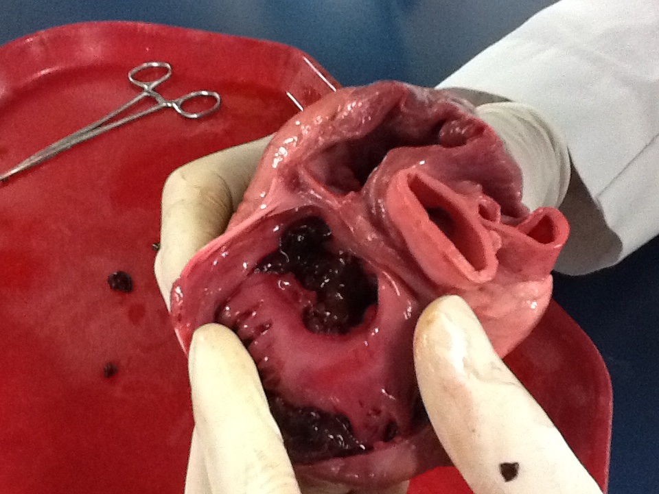 A dissected heart showing the thick-walled left and right ventricles that pump blood out. Credit: Kenshinb (CC BY-SA 3.0).