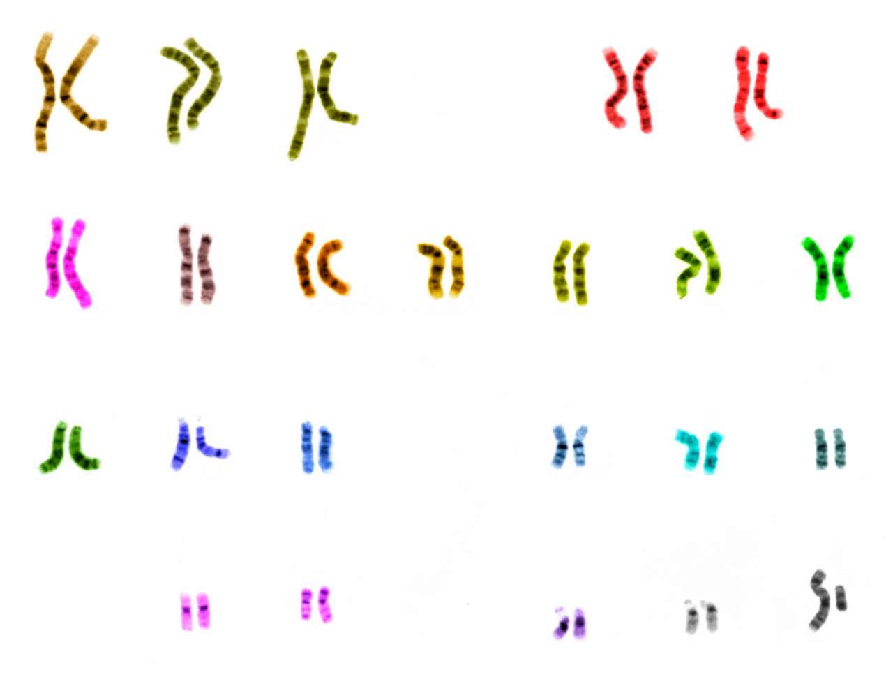 Human chromosomes. Under two per cent of the sequence codes for protein, and what the remainder does is the subject of a long and unresolved argument.