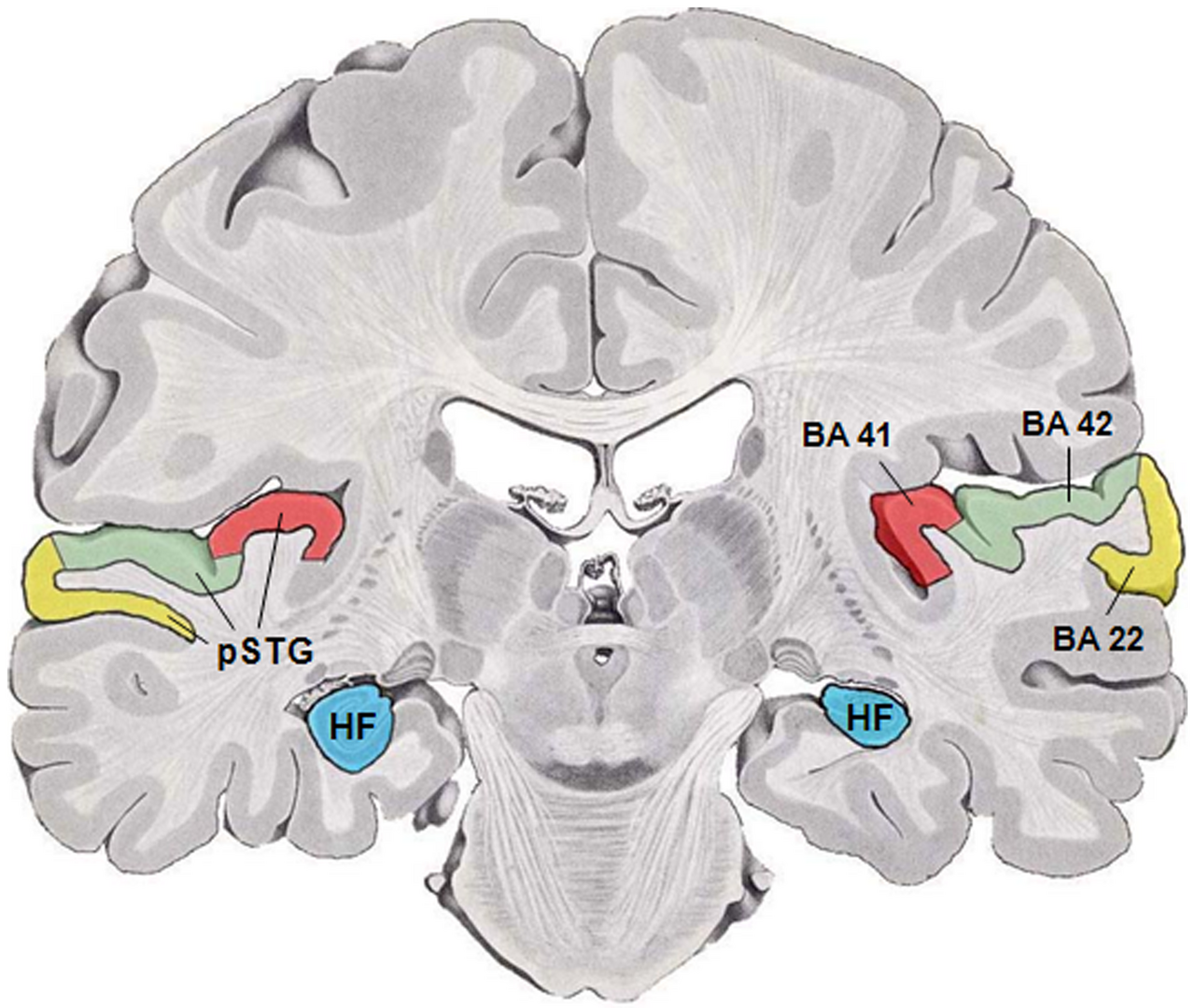 The temporal lobe. The superior temporal sulcus is the region most consistently implicated in combining auditory and visual speech, and damage there reduces the effect.