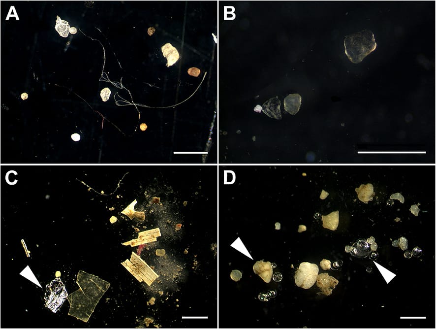 Microplastic particles recovered from river sediments. Environmental concentrations are rising and plastic production continues to increase, which sets the direction of exposure regardless of what the health evidence eventually shows.