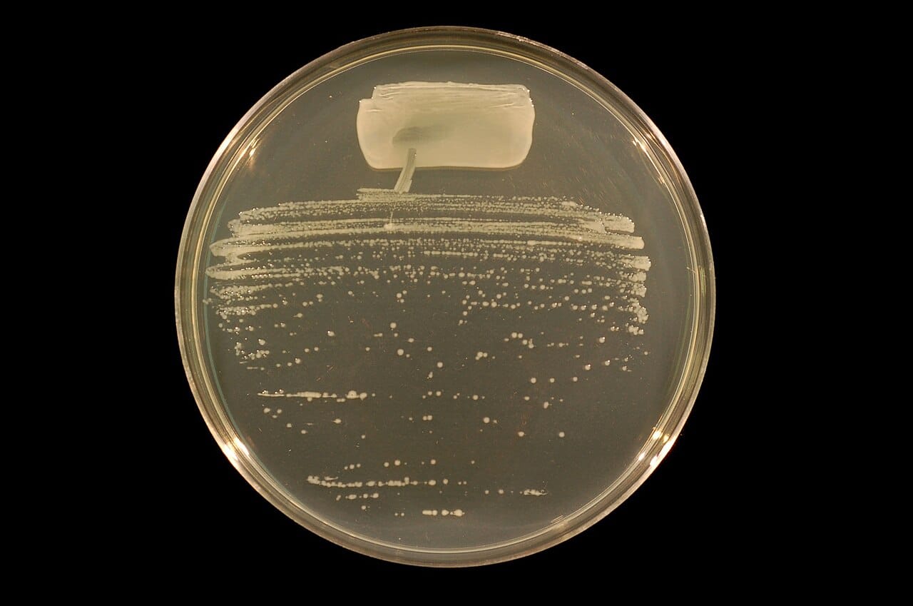 Rhizobium bacteria in culture. Nitrogen fixation is performed only by prokaryotes; every plant that appears to fix nitrogen is housing bacteria that do it.