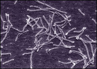Thermus aquaticus, isolated from a Yellowstone hot spring in 1969. Its DNA polymerase survives the temperatures the method requires, which is what allowed the process to be automated.