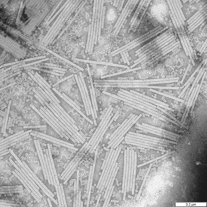 An electron micrograph of a virus; Franklin later did pioneering work on viruses.