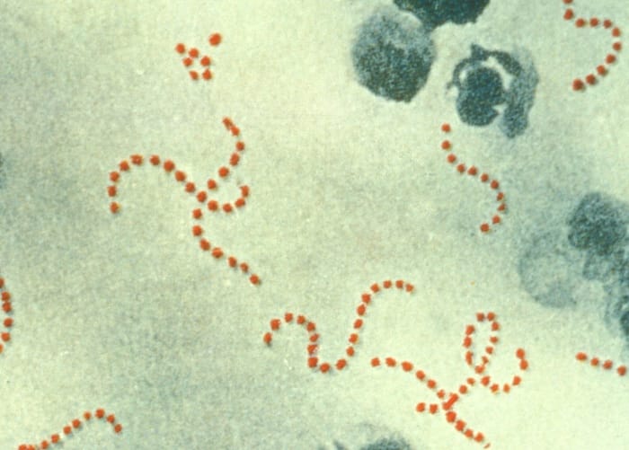 Streptococcus pyogenes, the organism principally responsible for puerperal fever. Its role was established decades after Semmelweis died.