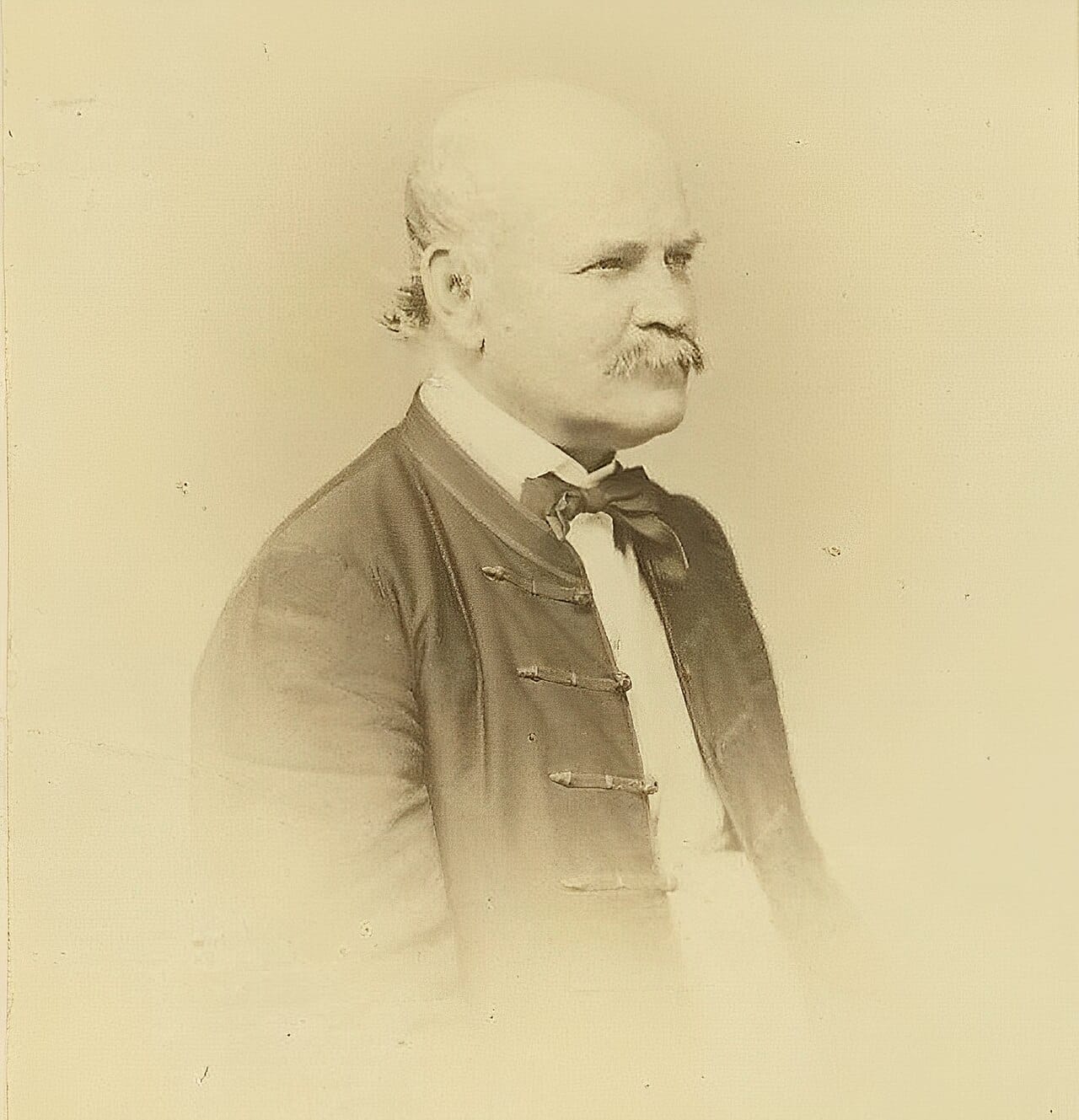 Ignaz Semmelweis, who identified the cause of puerperal fever in 1847 by comparing mortality between two clinics and testing an intervention against it.