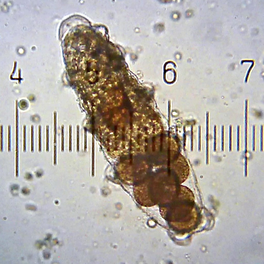 Tardigrade eggs laid inside a shed cuticle. Some species deposit eggs in the moulted skin, which protects them.