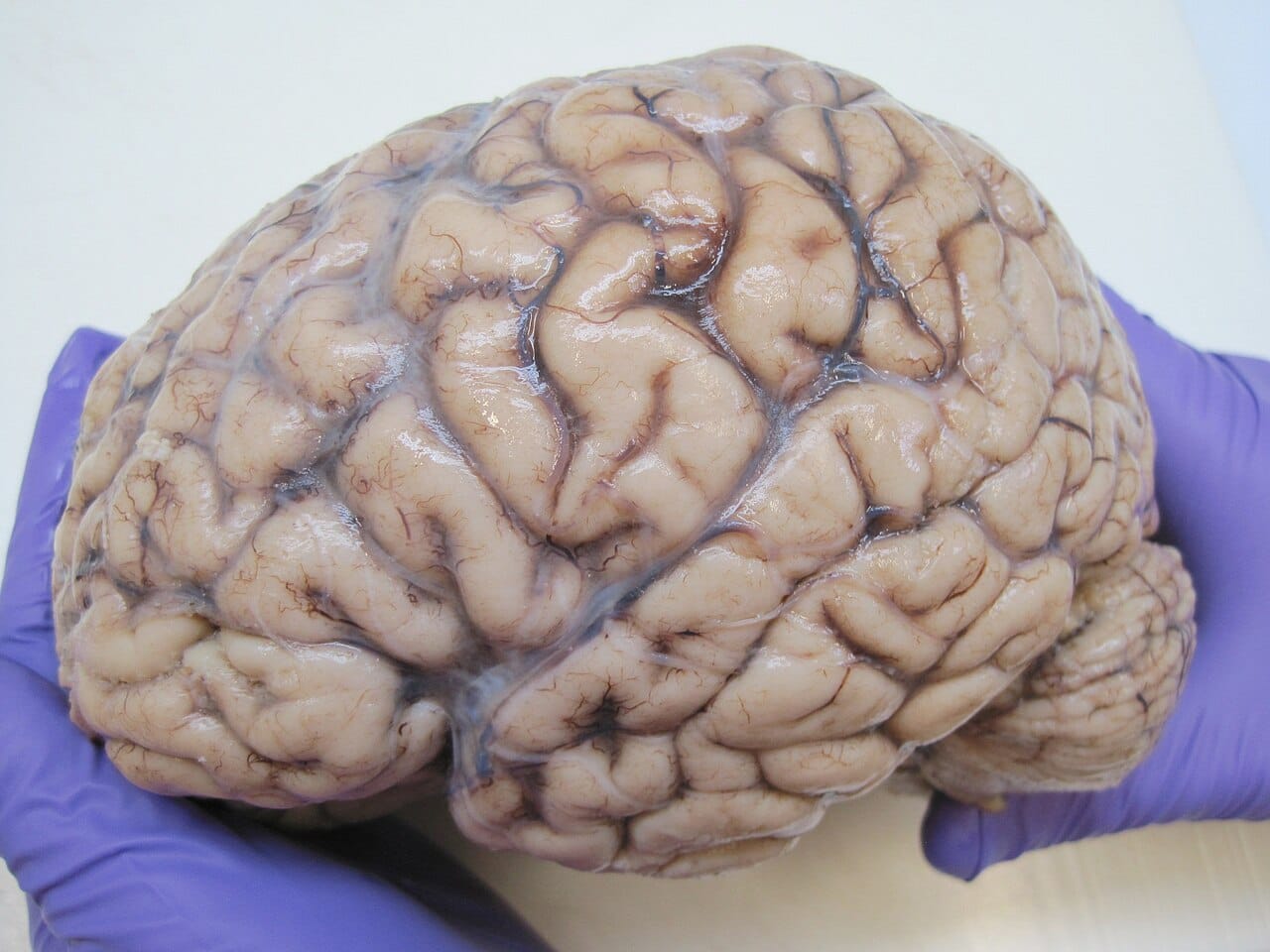 A human brain. Nothing in its structure corresponds to a large reserve of unused tissue, and there is no region whose loss is without consequence.