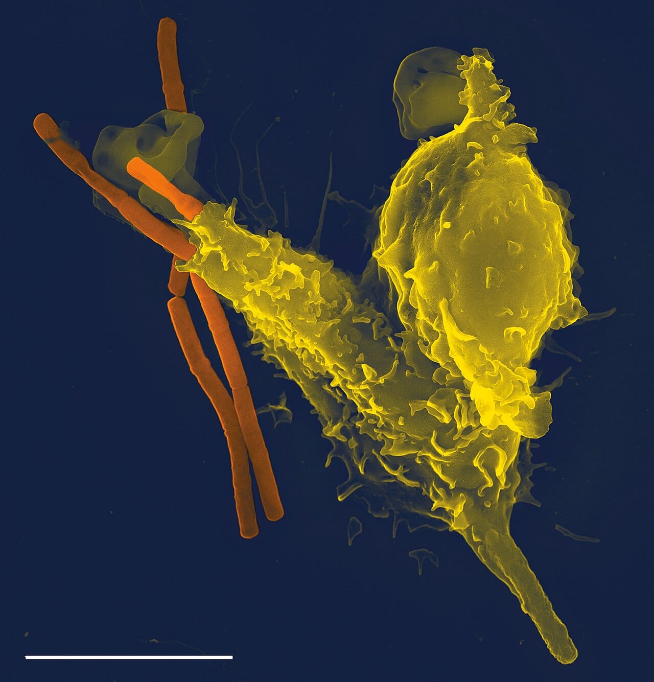 A neutrophil engulfing bacteria. Phagocytosis is among the oldest defences, present in animals long before adaptive immunity evolved.