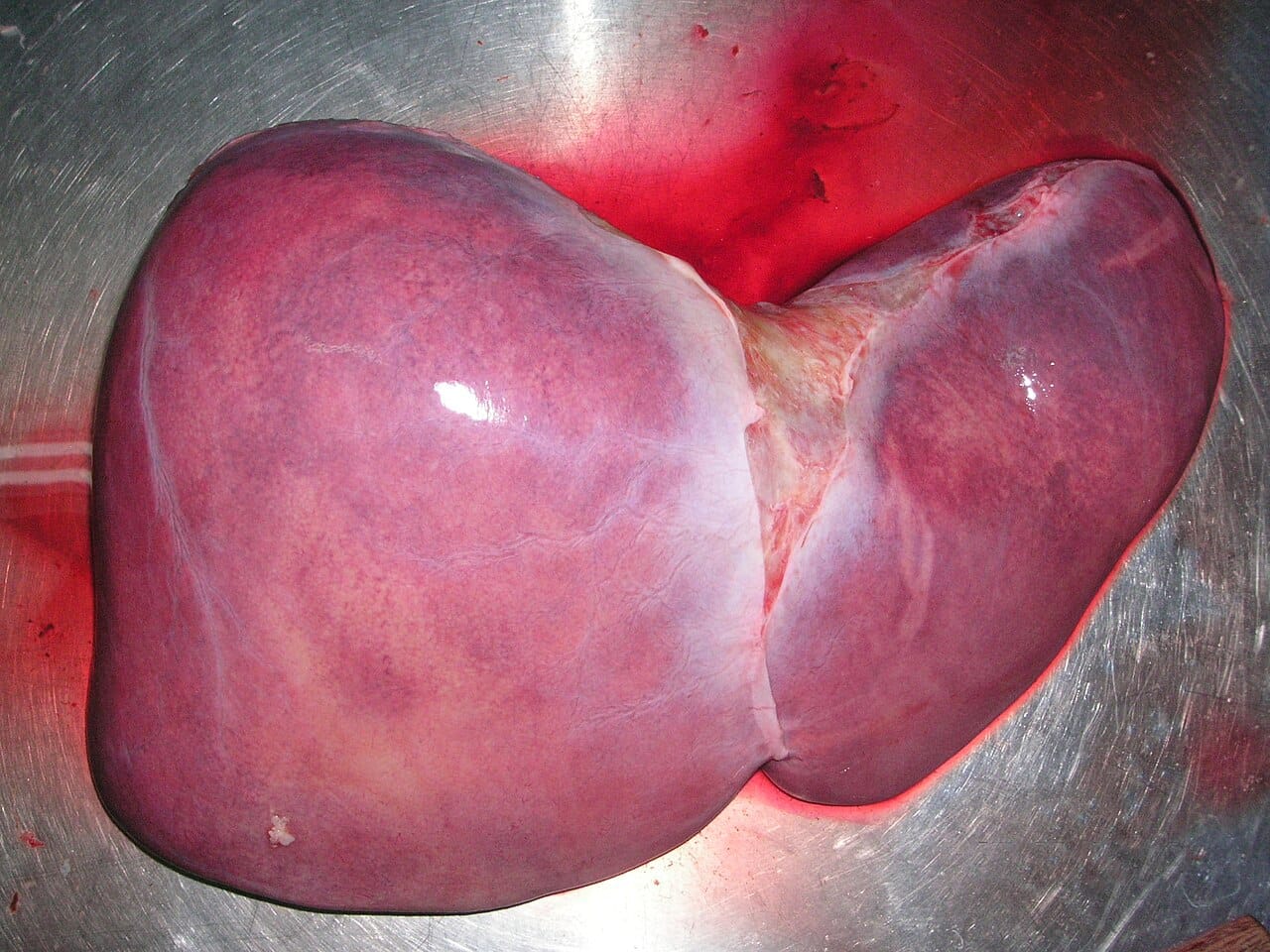 A human liver. It weighs roughly one and a half kilograms in an adult and sits mostly under the right side of the ribcage.
