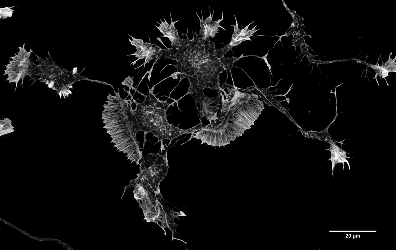 Cultured neurons. Growing them outside the body allows the physical basis of connection and signalling to be studied directly.