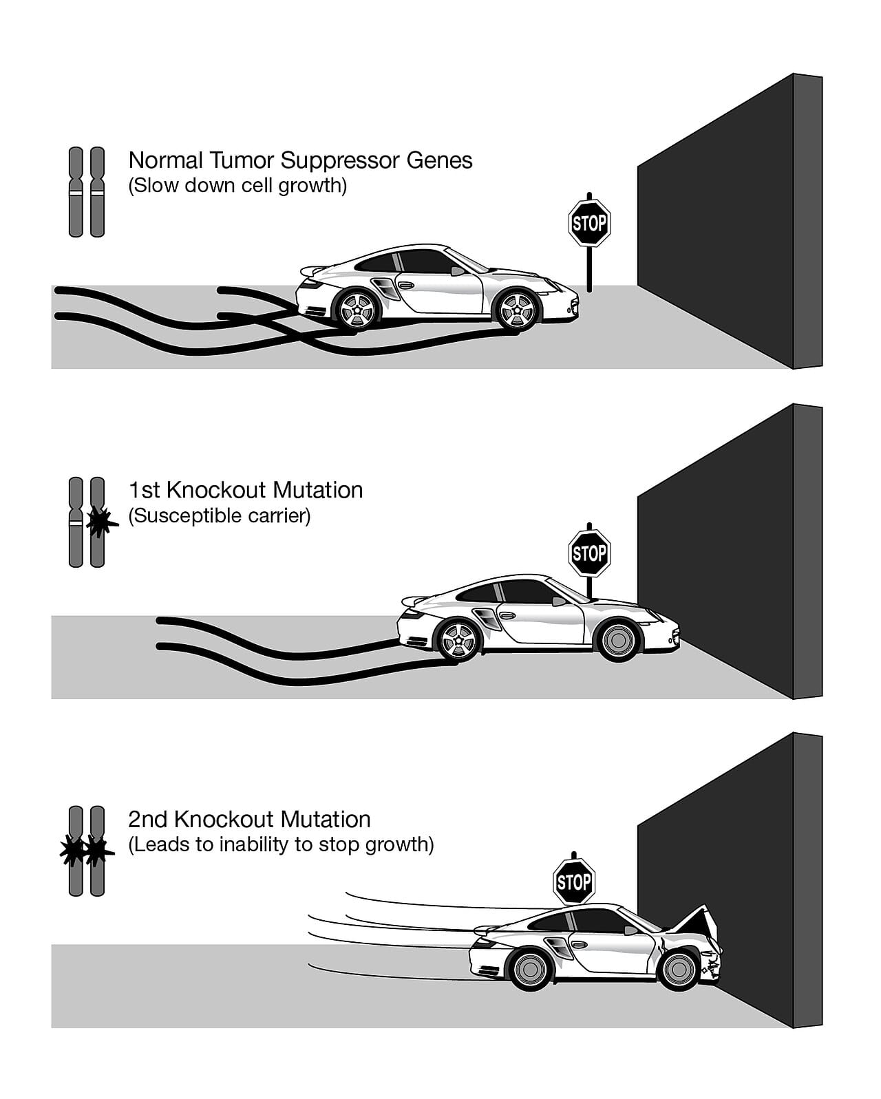 The two-hit model. A tumour suppressor requires both copies to be lost, which is why an inherited first hit produces earlier and multiple tumours.