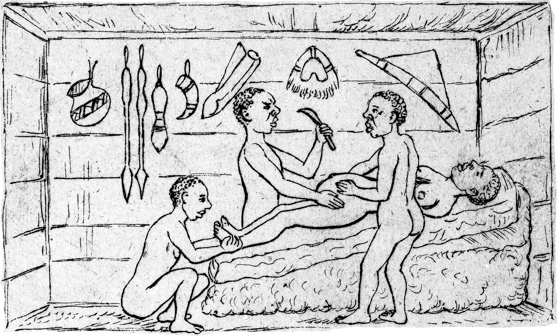 An 1879 European depiction of a caesarean section performed by indigenous healers in the kingdom of Bunyoro. Using banana wine as anaesthetic and careful technique, they achieved results that astonished Western observers, a testament to the sophistication of Uganda's kingdoms.