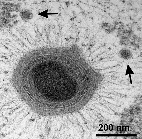 A mimivirus with a smaller virophage. Giant viruses of this kind have genomes larger than some bacteria and build replication compartments inside their hosts, which is the observation the hypothesis is built from.