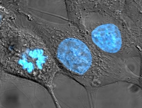 Stained cell nuclei. The nucleus has no genome of its own, which removes the line of evidence that made the endosymbiotic origin of mitochondria decisive.