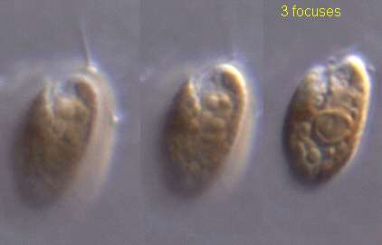 A eukaryotic cell. Mitochondria and chloroplasts have a settled endosymbiotic origin; the nucleus does not.