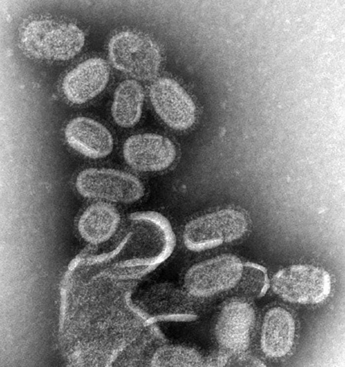 Influenza virus particles. The envelope around them is taken from the membrane of the cell the virus left, which is why enveloped viruses are readily destroyed by soap.