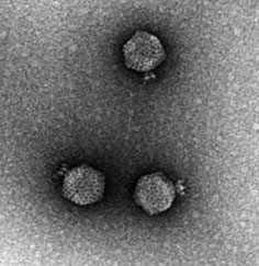 A bacteriophage, a virus infecting bacteria. The head encloses the genome and the tail apparatus delivers it through the bacterial cell wall.