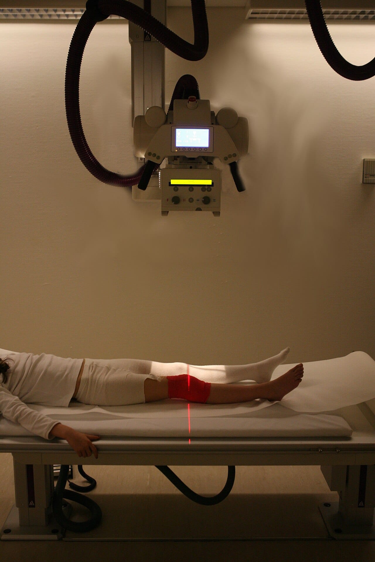 A radiography installation. The image is a shadow cast by differential absorption, which is why bone appears clearly and soft tissues of similar density do not.